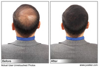 before and after picture of the back of the head of a male model using juveker hair fibers to conceal thinning hair and bald spots. link to juveker.com