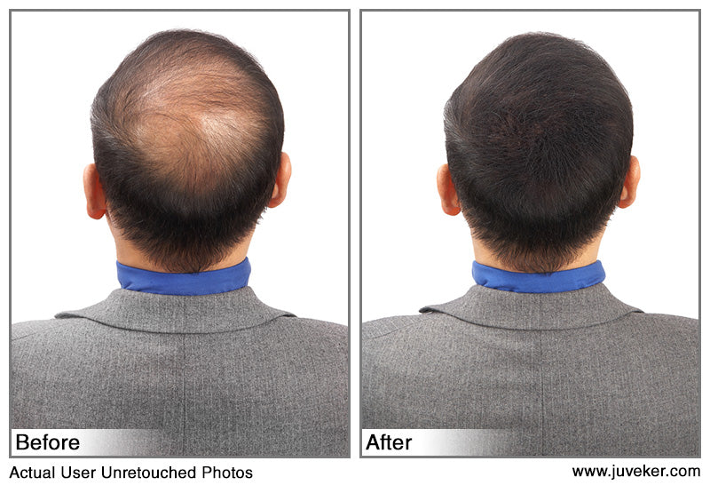 before and after picture of the back of the head of a male model using juveker hair fibers to conceal thinning hair and bald spots. link to juveker.com