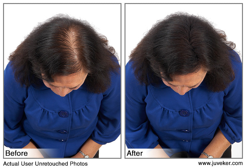 before and after picture of female model applying juveker to the top of the hair to conceal bald spot